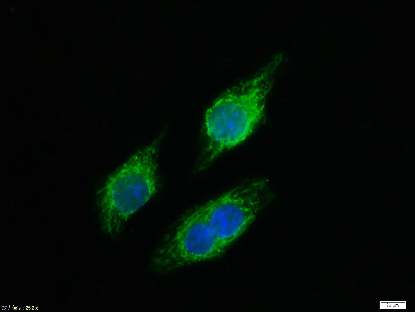 Tissue/cell:MCF7 cell; 4% Paraformaldehyde-fixed; Triton X-100 at room temperature for 20 min; Blocking buffer (normal goat serum,C-0005) at 37°C for 20 min; Antibody incubation with (phospho-NFKB p65 (Thr435)) polyclonal Antibody, Unconjugated (bs-5661R) 1:100, 90 minutes at 37°C; followed by a FITC conjugated Goat Anti-Rabbit IgG antibody at 37°C for 90 minutes, DAPI (blue, C02-04002) was used to stain the cell nuclei.