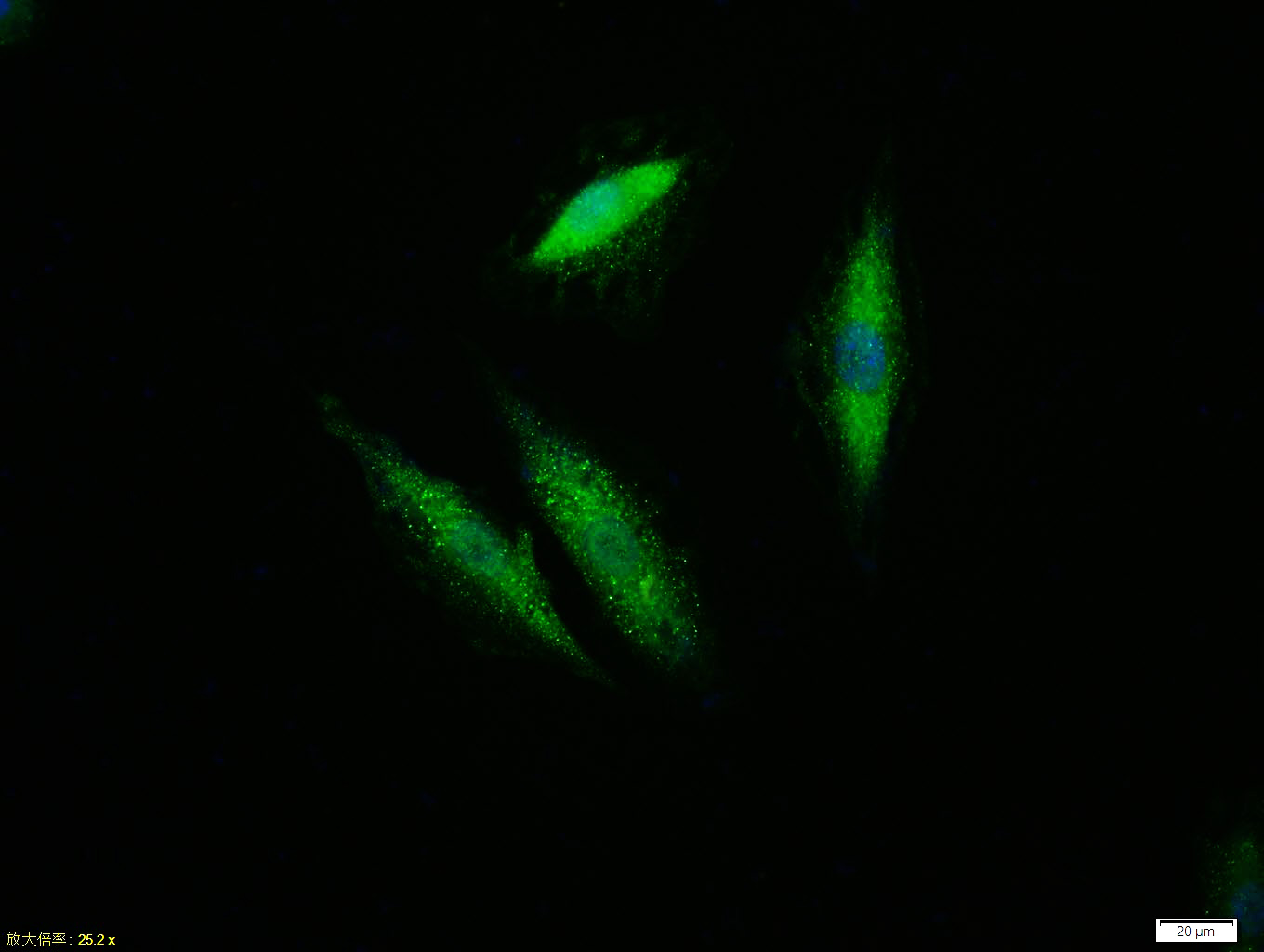 Tissue/cell:A549 cell;4% Paraformaldehyde-fixed;Triton X-100 at room temperature for 20 min; Blocking buffer (normal goat serum,C-0005) at 37°C for 20 min; Antibody incubation with (ERK1/2) monoclonal Antibody, Unconjugated (bsm-52259R) 1:100, 90 minutes at 37°C; followed by a FITC conjugated Goat Anti-Rabbit IgG antibody at 37°C for 90 minutes, DAPI (blue, C02-04002) was used to stain the cell nuclei.