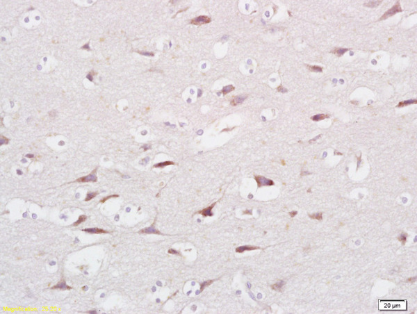 Formalin-fixed and paraffin embedded human brain labeled with Anti FAM40A Polyclonal Antibody, Unconjugated (bs-8194R) at 1:200 followed by conjugation to the secondary antibody and DAB staining