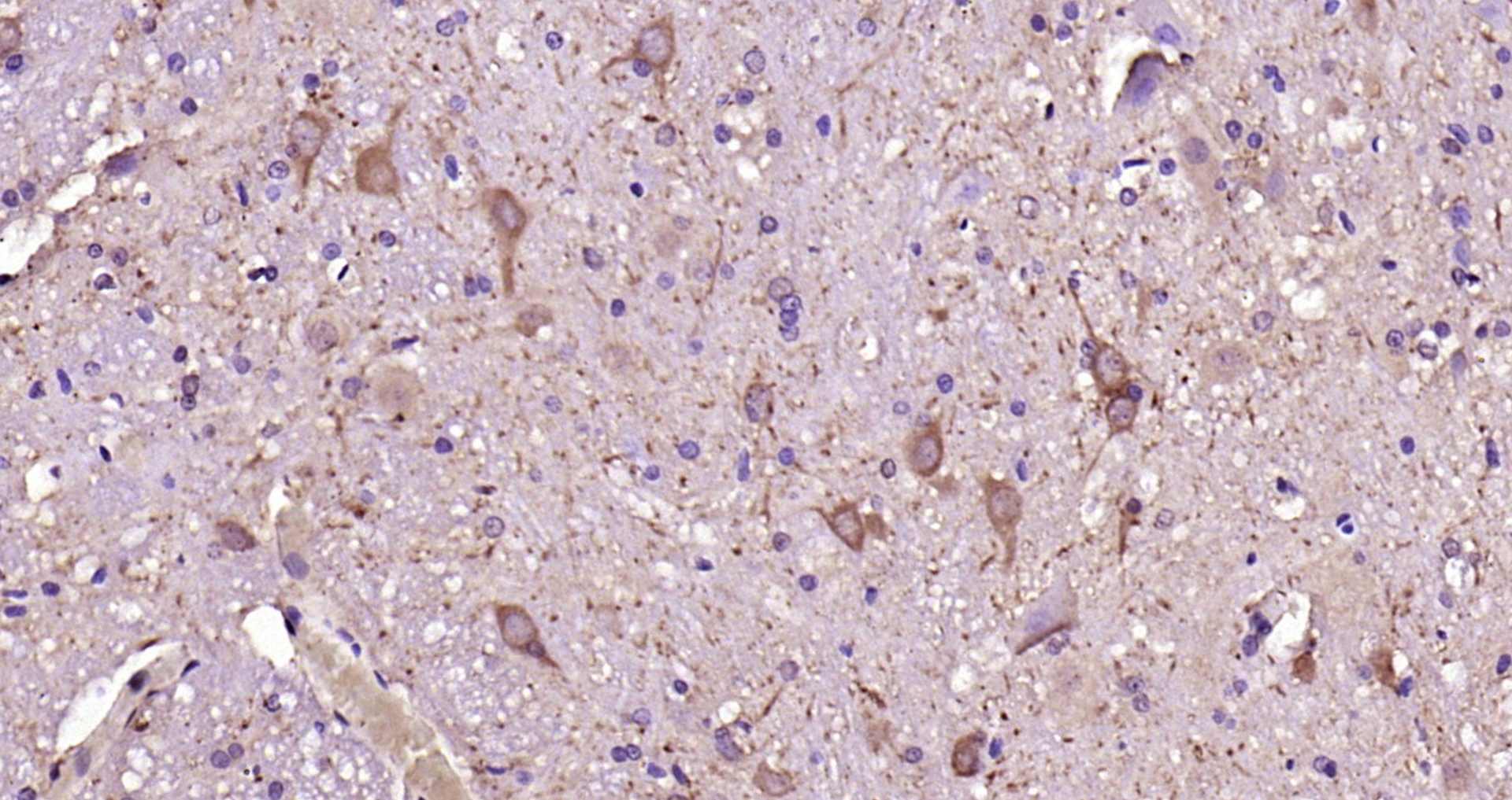 Paraformaldehyde-fixed, paraffin embedded Rat spinal cord; Antigen retrieval by boiling in sodium citrate buffer (pH6.0) for 15min; Block endogenous peroxidase by 3% hydrogen peroxide for 20 minutes; Blocking buffer (normal goat serum) at 37°C for 30min; Antibody incubation with GDNF Polyclonal Antibody, Unconjugated (bs-1024R) at 1:200 overnight at 4°C, DAB staining.