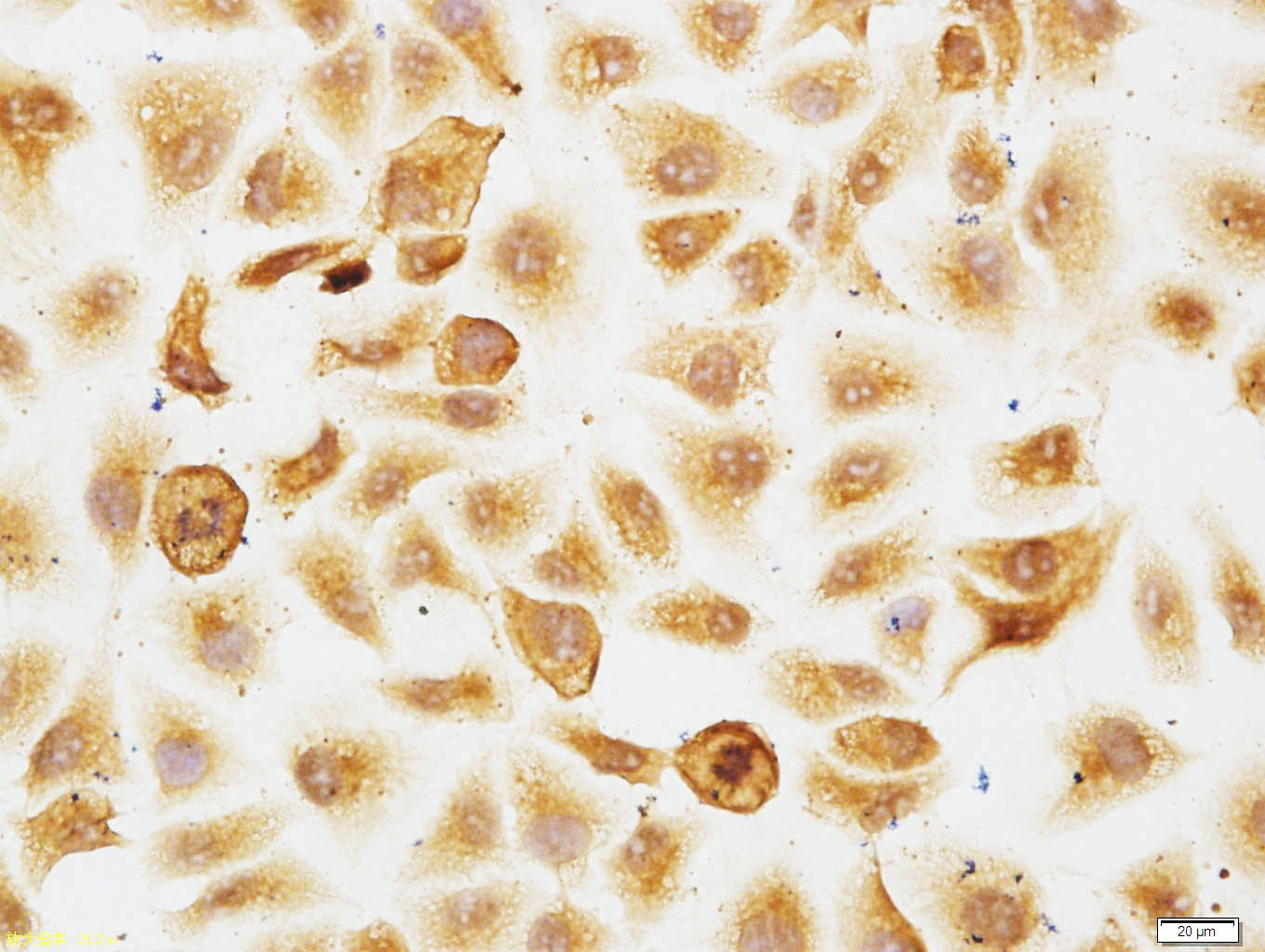 HUVEC cells were stained with GIMAP2 Polyclonal Antibody, Unconjugated bs-8268R at 1:150 in PBS and incubated for two hours at 37°C, followed by operating according to SP Kit(Rabbit) (sp-0023) instructionsand DAB staining.