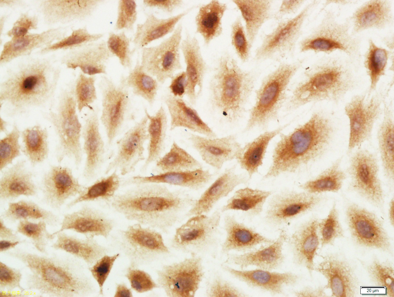 A549 cells were stained with PRR15 Polyclonal Antibody, Unconjugated bs-9408R at 1:100 in PBS and incubated for two hours at 37°C, followed by operating according to SP Kit(Rabbit) (sp-0023) instructionsand DAB staining.