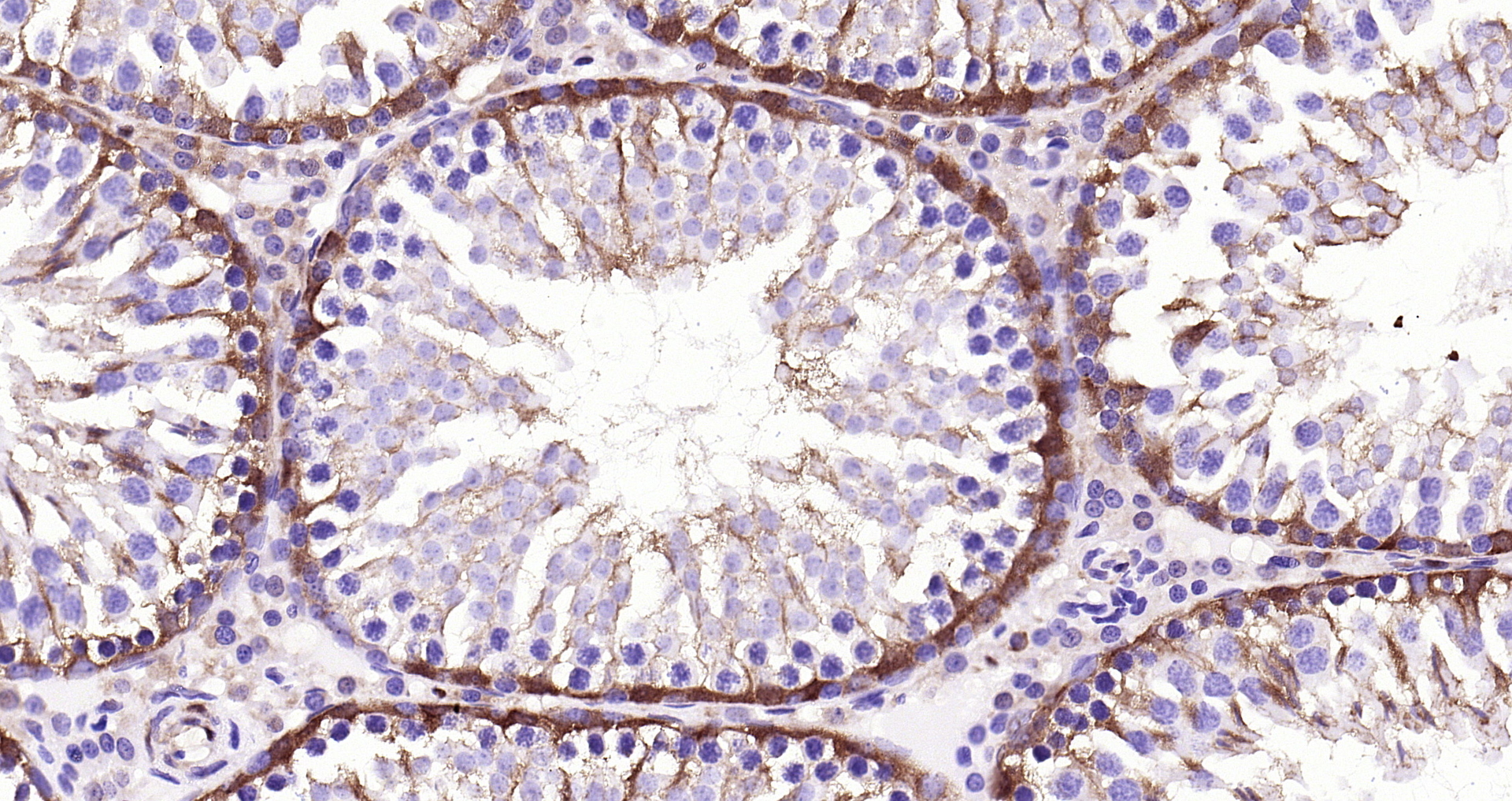 Paraformaldehyde-fixed, paraffin embedded Rat testis; Antigen retrieval by boiling in sodium citrate buffer (pH6.0) for 15min; Block endogenous peroxidase by 3% hydrogen peroxide for 20 minutes; Blocking buffer (normal goat serum) at 37°C for 30min; Antibody incubation with GAPDH (3B5) Monoclonal Antibody, Unconjugated (bsm-52262R) at 1:200 overnight at 4°C, DAB staining.