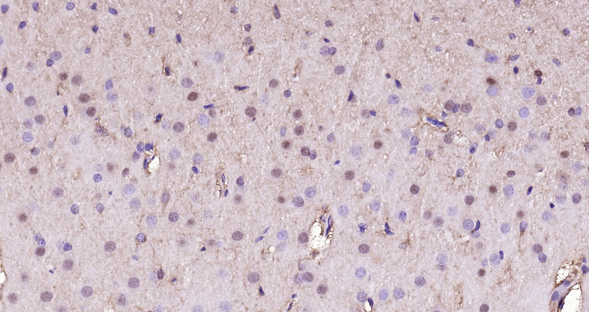 Paraformaldehyde-fixed, paraffin embedded Rat brain; Antigen retrieval by boiling in sodium citrate buffer (pH6.0) for 15min; Block endogenous peroxidase by 3% hydrogen peroxide for 20 minutes; Blocking buffer (normal goat serum) at 37°C for 30min; Antibody incubation with GAPDH (3B5) Monoclonal Antibody, Unconjugated (bsm-52262R) at 1:200 overnight at 4°C, DAB staining.