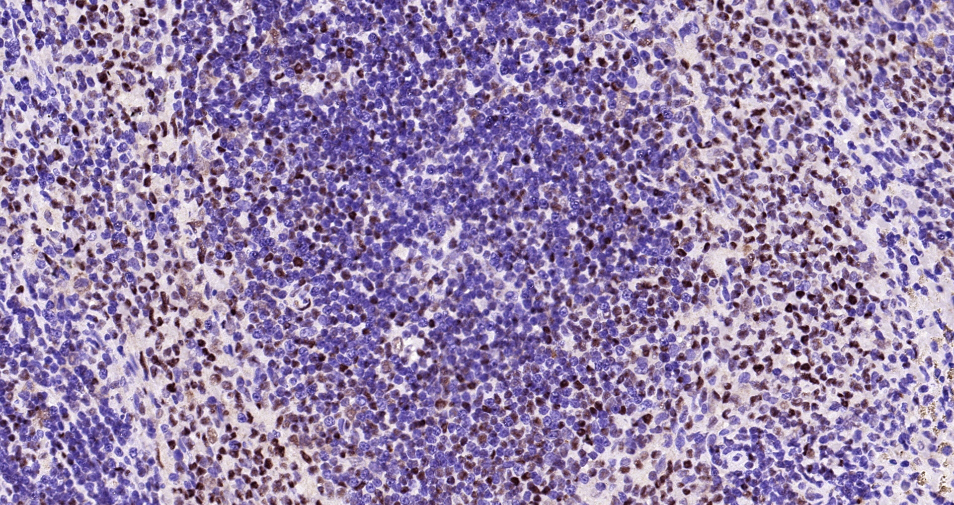 Paraformaldehyde-fixed, paraffin embedded Rat spleen; Antigen retrieval by boiling in sodium citrate buffer (pH6.0) for 15min; Block endogenous peroxidase by 3% hydrogen peroxide for 20 minutes; Blocking buffer (normal goat serum) at 37°C for 30min; Antibody incubation with GAPDH (3B5) Monoclonal Antibody, Unconjugated (bsm-52262R) at 1:200 overnight at 4°C, DAB staining.