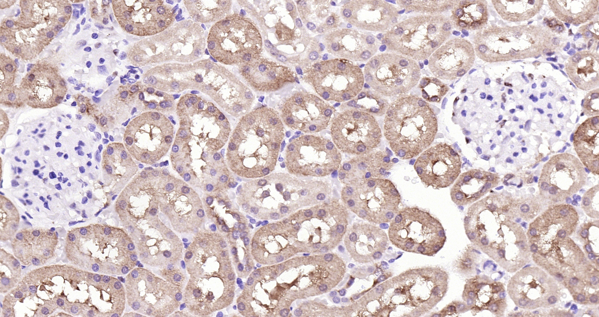 Paraformaldehyde-fixed, paraffin embedded Rat kidney; Antigen retrieval by boiling in sodium citrate buffer (pH6.0) for 15min; Block endogenous peroxidase by 3% hydrogen peroxide for 20 minutes; Blocking buffer (normal goat serum) at 37°C for 30min; Antibody incubation with GAPDH (3B5) Monoclonal Antibody, Unconjugated (bsm-52262R) at 1:200 overnight at 4°C, DAB staining.