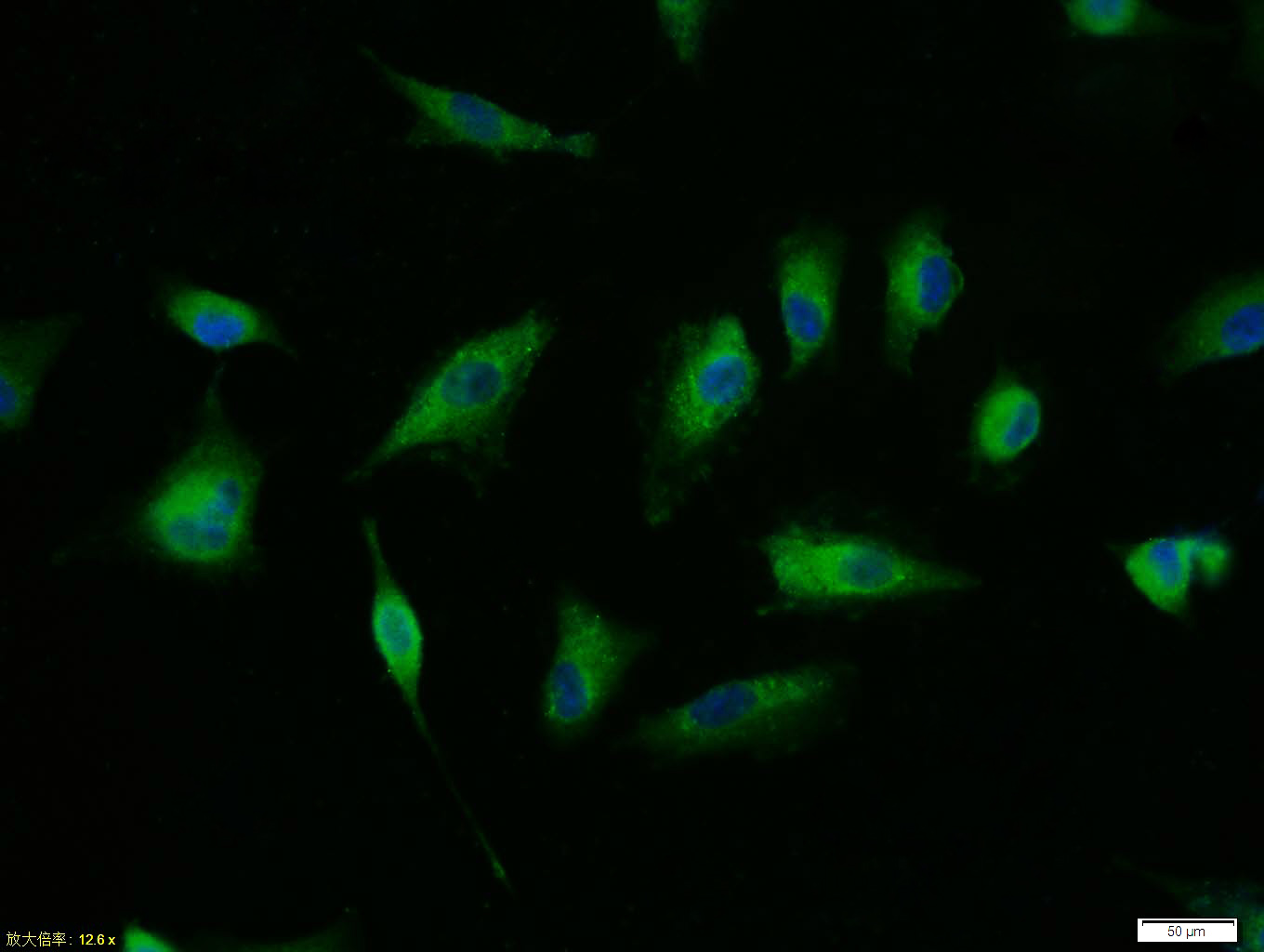 Tissue/cell:A549 cell; 4% Paraformaldehyde-fixed; Triton X-100 at room temperature for 20 min; Blocking buffer (normal goat serum,C-0005) at 37°C for 20 min; Antibody incubation with (phospho-TERT (Ser1125)) polyclonal Antibody, Unconjugated (bs-5605R) 1:100, 90 minutes at 37°C; followed by a FITC conjugated Goat Anti-Rabbit IgG antibody at 37°C for 90 minutes, DAPI (blue, C02-04002) was used to stain the cell nuclei.