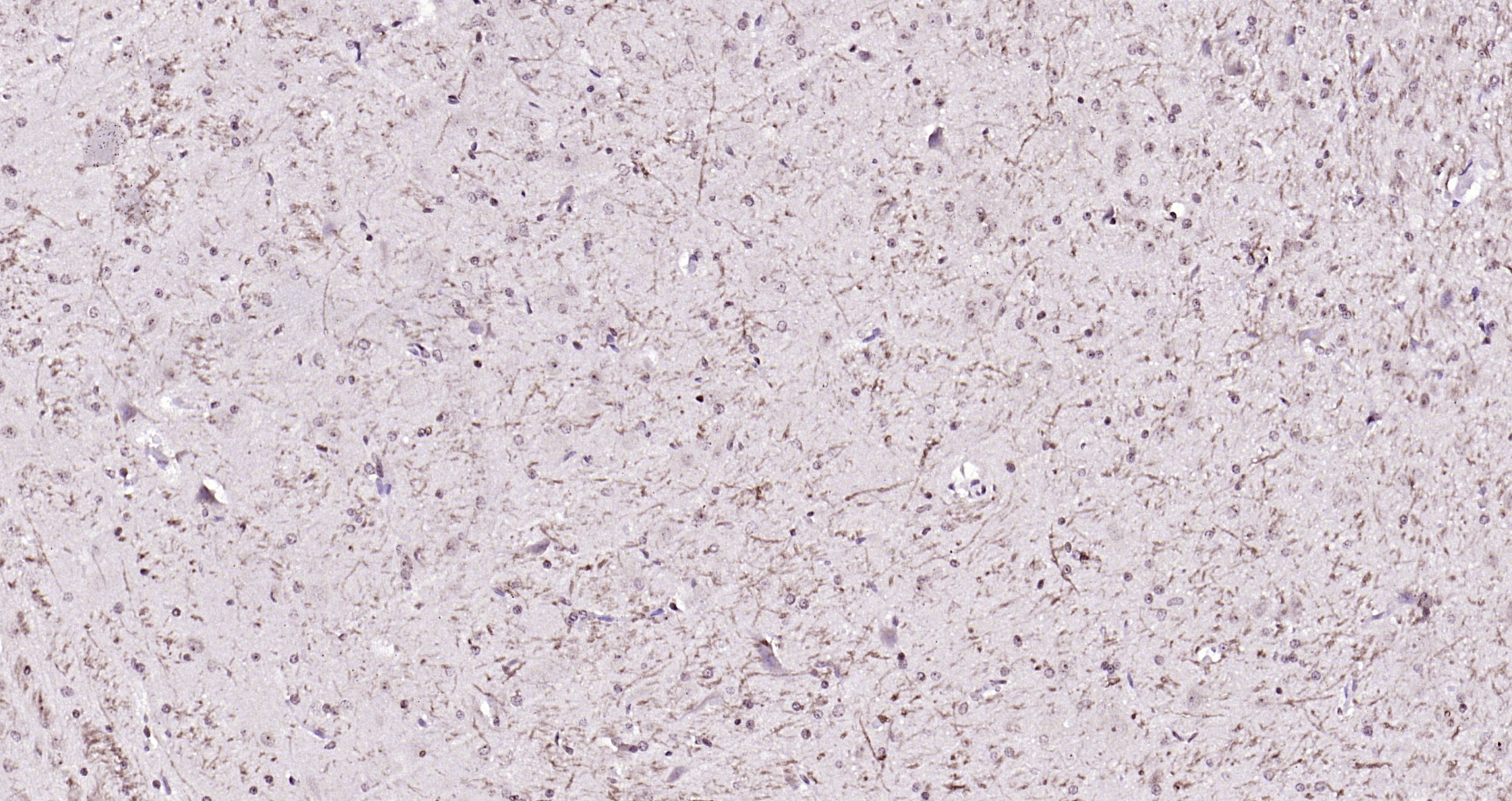 Paraformaldehyde-fixed, paraffin embedded Rat brain; Antigen retrieval by boiling in sodium citrate buffer (pH6.0) for 15min; Block endogenous peroxidase by 3% hydrogen peroxide for 20 minutes; Blocking buffer (normal goat serum) at 37°C for 30min; Antibody incubation with Notch1/MOTC Polyclonal Antibody, Unconjugated (bs-1335R) at 1:200 overnight at 4°C, DAB staining.