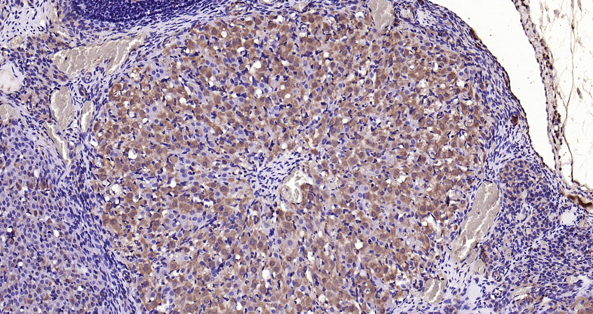 Paraformaldehyde-fixed, paraffin embedded Rat ovarian; Antigen retrieval by boiling in sodium citrate buffer (pH6.0) for 15min; Block endogenous peroxidase by 3% hydrogen peroxide for 20 minutes; Blocking buffer (normal goat serum) at 37°C for 30min; Antibody incubation with WNT5A Polyclonal Antibody, Unconjugated (bs-1948R) at 1:200 overnight at 4°C, DAB staining.