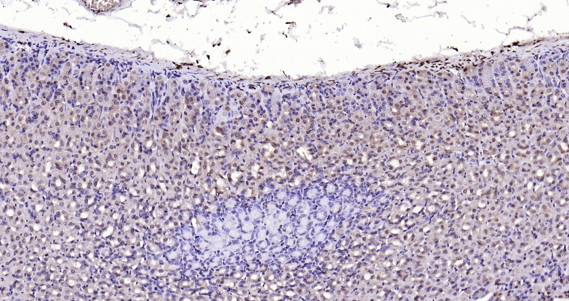 Paraformaldehyde-fixed, paraffin embedded Mouse stomach; Antigen retrieval by boiling in sodium citrate buffer (pH6.0) for 15min; Block endogenous peroxidase by 3% hydrogen peroxide for 20 minutes; Blocking buffer (normal goat serum) at 37°C for 30min; Antibody incubation with LSM3 Polyclonal Antibody, Unconjugated (bs-18428R) at 1:200 overnight at 4°C, DAB staining.