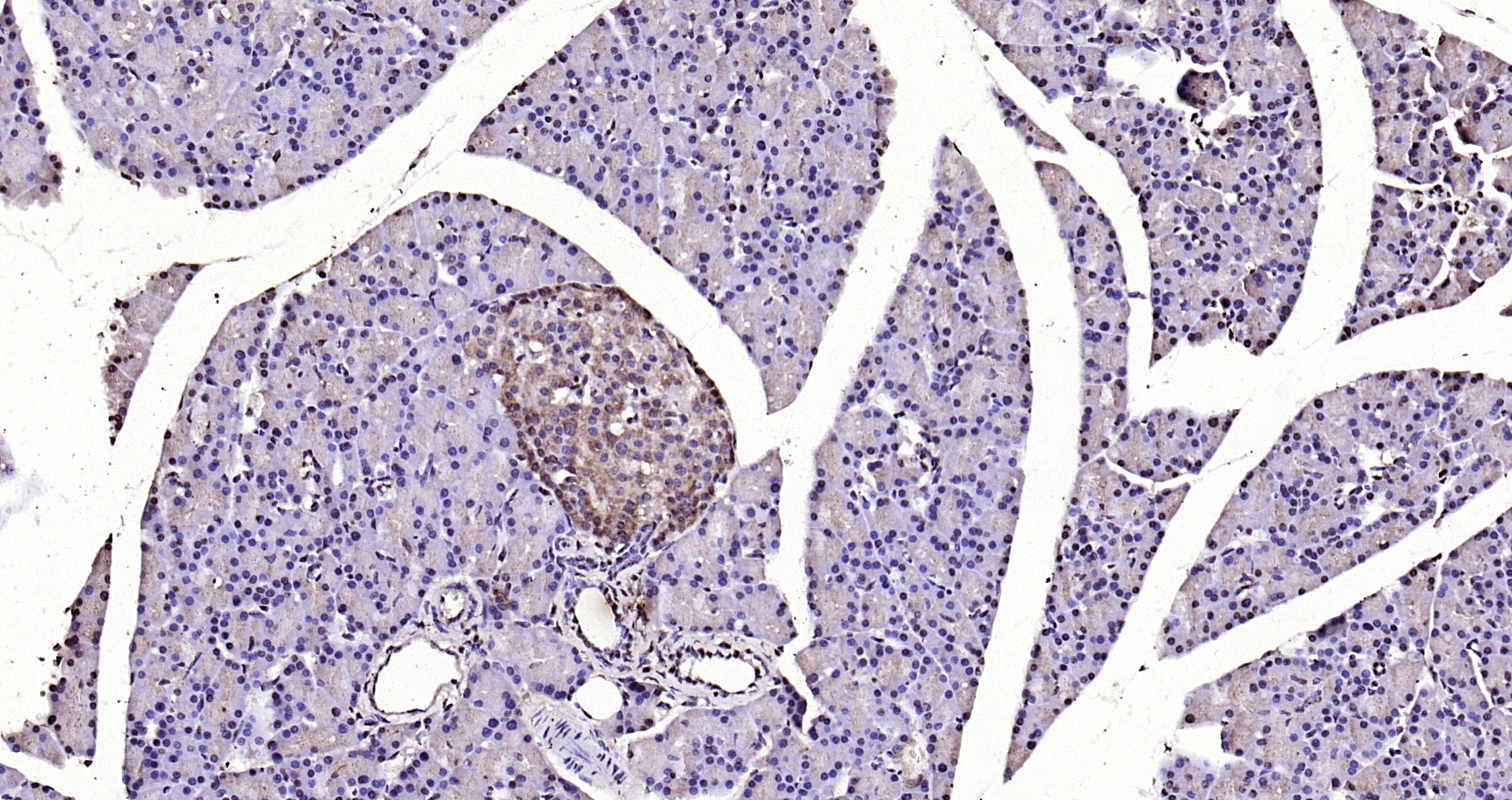 Paraformaldehyde-fixed, paraffin embedded Mouse pancreas; Antigen retrieval by boiling in sodium citrate buffer (pH6.0) for 15min; Block endogenous peroxidase by 3% hydrogen peroxide for 20 minutes; Blocking buffer (normal goat serum) at 37°C for 30min; Antibody incubation with LSM3 Polyclonal Antibody, Unconjugated (bs-18428R) at 1:200 overnight at 4°C, DAB staining.