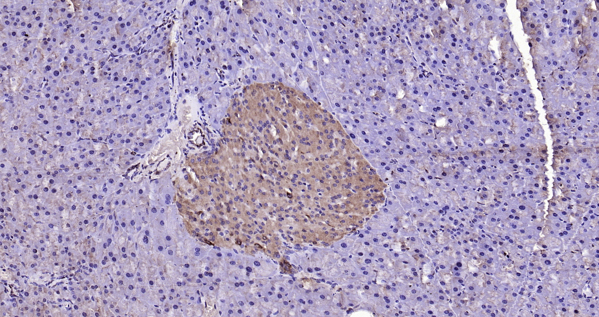 Paraformaldehyde-fixed, paraffin embedded Rat pancreas; Antigen retrieval by boiling in sodium citrate buffer (pH6.0) for 15min; Block endogenous peroxidase by 3% hydrogen peroxide for 20 minutes; Blocking buffer (normal goat serum) at 37°C for 30min; Antibody incubation with LSM3 Polyclonal Antibody, Unconjugated (bs-18428R) at 1:200 overnight at 4°C, DAB staining.
