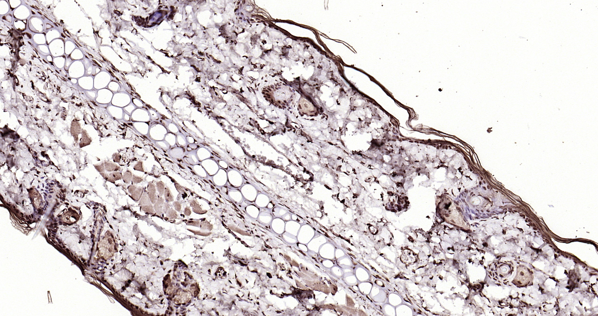 Paraformaldehyde-fixed, paraffin embedded Rat skin; Antigen retrieval by boiling in sodium citrate buffer (pH6.0) for 15min; Block endogenous peroxidase by 3% hydrogen peroxide for 20 minutes; Blocking buffer (normal goat serum) at 37°C for 30min; Antibody incubation with LSM3 Polyclonal Antibody, Unconjugated (bs-18428R) at 1:200 overnight at 4°C, DAB staining.