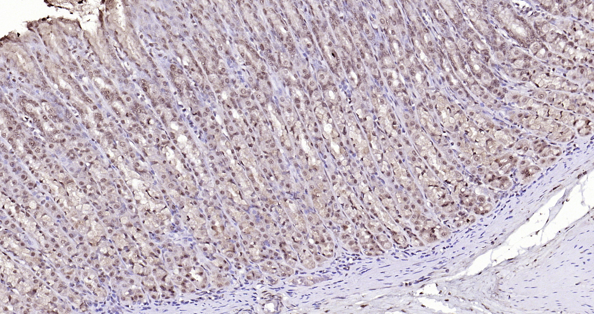 Paraformaldehyde-fixed, paraffin embedded Rat stomach; Antigen retrieval by boiling in sodium citrate buffer (pH6.0) for 15min; Block endogenous peroxidase by 3% hydrogen peroxide for 20 minutes; Blocking buffer (normal goat serum) at 37°C for 30min; Antibody incubation with LSM3 Polyclonal Antibody, Unconjugated (bs-18428R) at 1:200 overnight at 4°C, DAB staining.