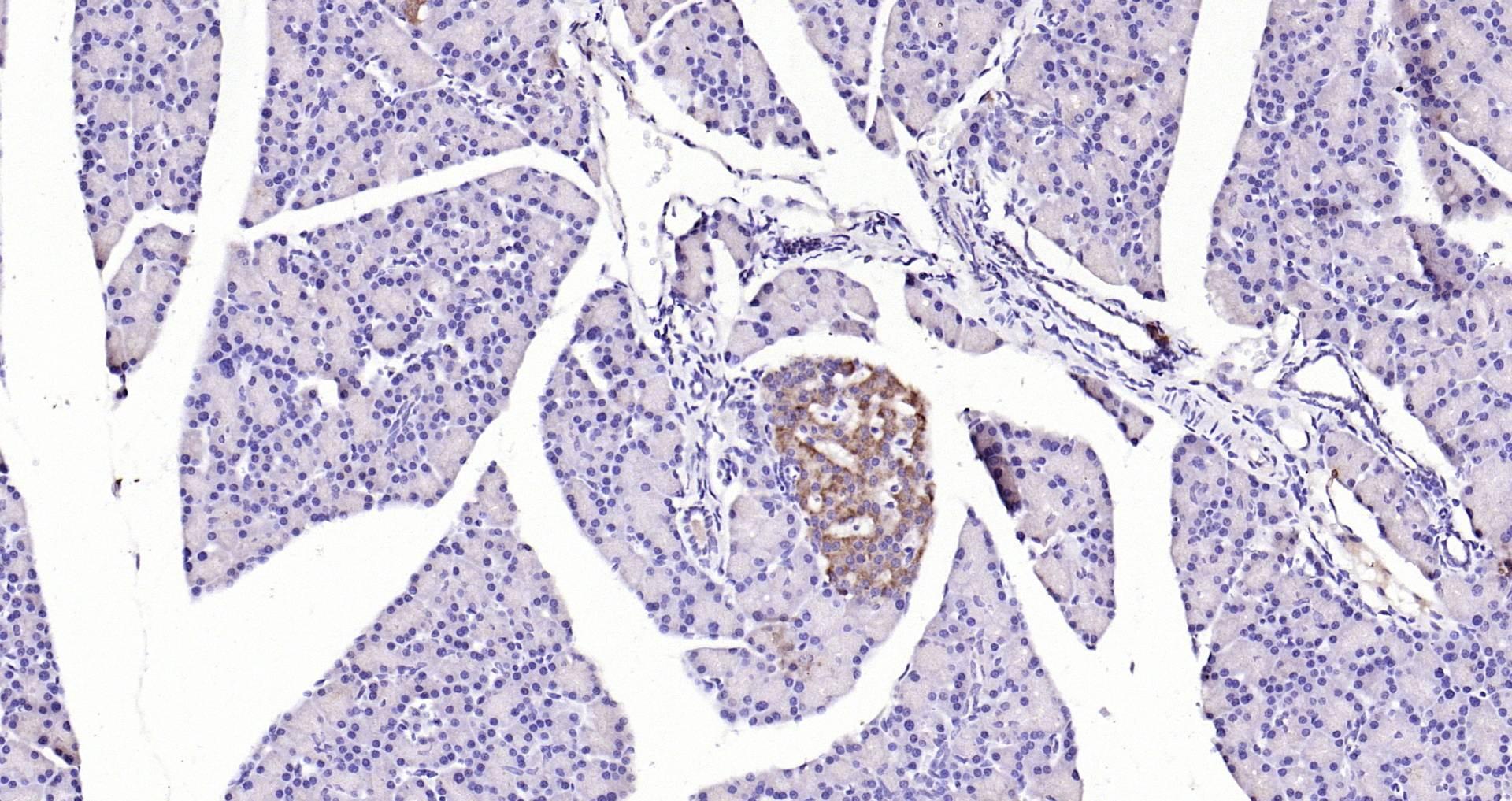 Paraformaldehyde-fixed, paraffin embedded Mouse pancreas; Antigen retrieval by boiling in sodium citrate buffer (pH6.0) for 15min; Block endogenous peroxidase by 3% hydrogen peroxide for 20 minutes; Blocking buffer (normal goat serum) at 37°C for 30min; Antibody incubation with GPR49/LGR5 Polyclonal Antibody, Unconjugated (bs-20746R) at 1:200 overnight at 4°C, DAB staining. Paraformaldehyde-fixed, paraffin embedded Mouse pancreas; Antigen retrieval by boiling in sodium citrate buffer (pH6.0) for 15min; Block endogenous peroxidase by 3% hydrogen peroxide for 20 minutes; Blocking buffer (normal goat serum) at 37°C for 30min; Antibody incubation with GPR49/LGR5 Polyclonal Antibody, Unconjugated (bs-20746R) at 1:200 overnight at 4°C, DAB staining.