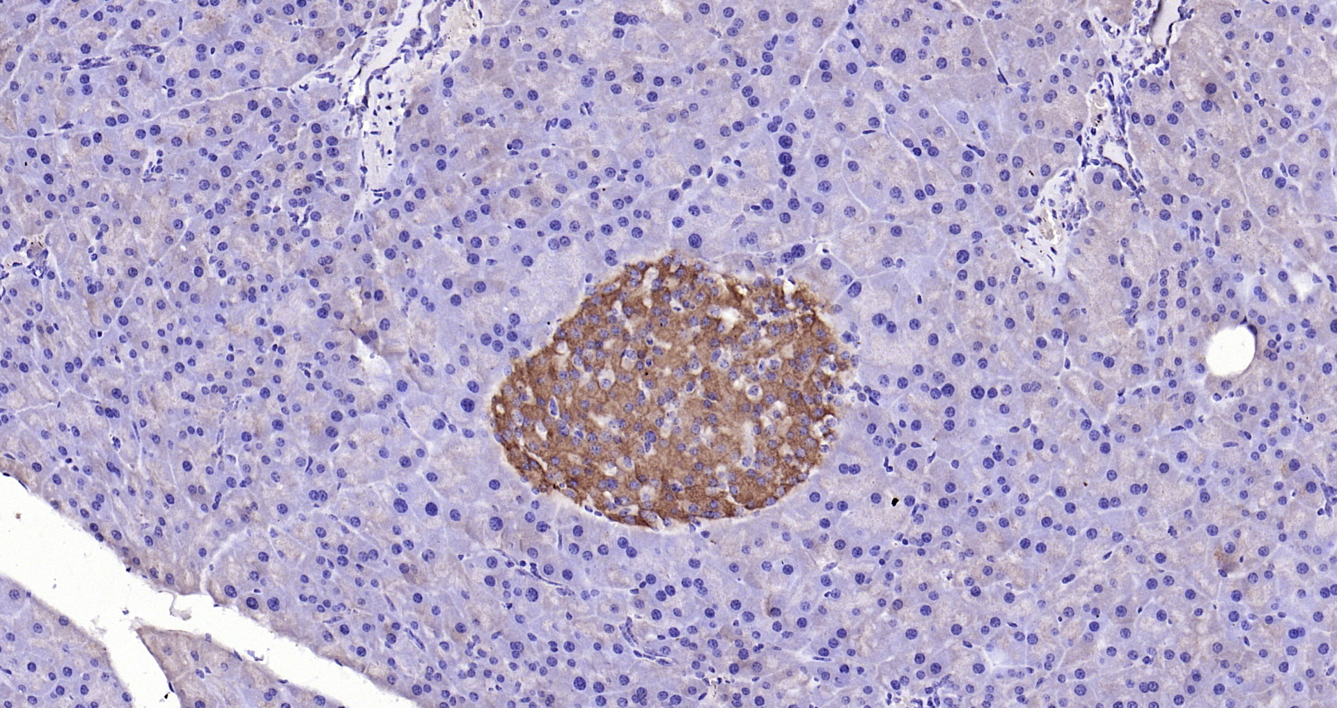 Paraformaldehyde-fixed, paraffin embedded Rat pancreas; Antigen retrieval by boiling in sodium citrate buffer (pH6.0) for 15min; Block endogenous peroxidase by 3% hydrogen peroxide for 20 minutes; Blocking buffer (normal goat serum) at 37°C for 30min; Antibody incubation with GPR49/LGR5 Polyclonal Antibody, Unconjugated (bs-20746R) at 1:200 overnight at 4°C, DAB staining. Paraformaldehyde-fixed, paraffin embedded Rat pancreas; Antigen retrieval by boiling in sodium citrate buffer (pH6.0) for 15min; Block endogenous peroxidase by 3% hydrogen peroxide for 20 minutes; Blocking buffer (normal goat serum) at 37°C for 30min; Antibody incubation with GPR49/LGR5 Polyclonal Antibody, Unconjugated (bs-20746R) at 1:200 overnight at 4°C, DAB staining.