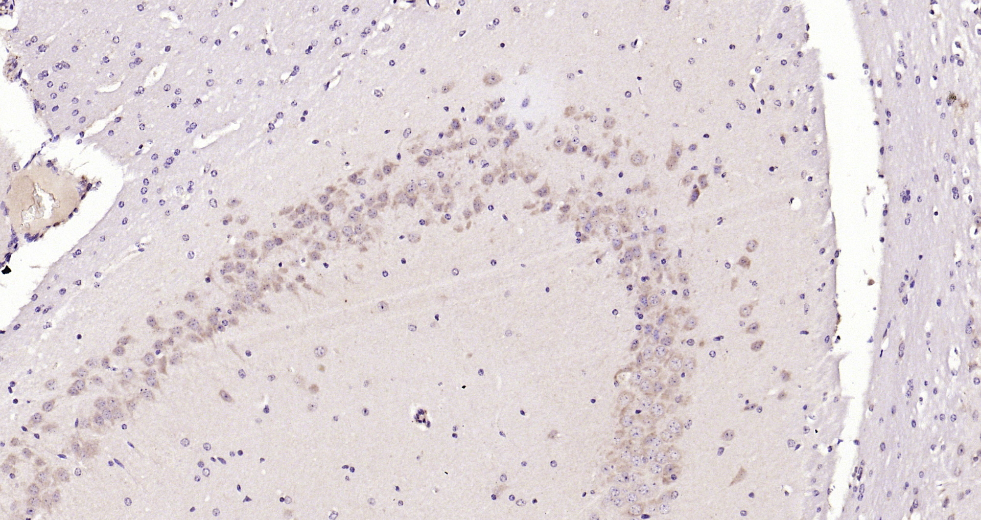 Paraformaldehyde-fixed, paraffin embedded Mouse brain; Antigen retrieval by boiling in sodium citrate buffer (pH6.0) for 15min; Block endogenous peroxidase by 3% hydrogen peroxide for 20 minutes; Blocking buffer (normal goat serum) at 37°C for 30min; Antibody incubation with MCL1 Polyclonal Antibody, Unconjugated (bs-23315R) at 1:200 overnight at 4°C, DAB staining.