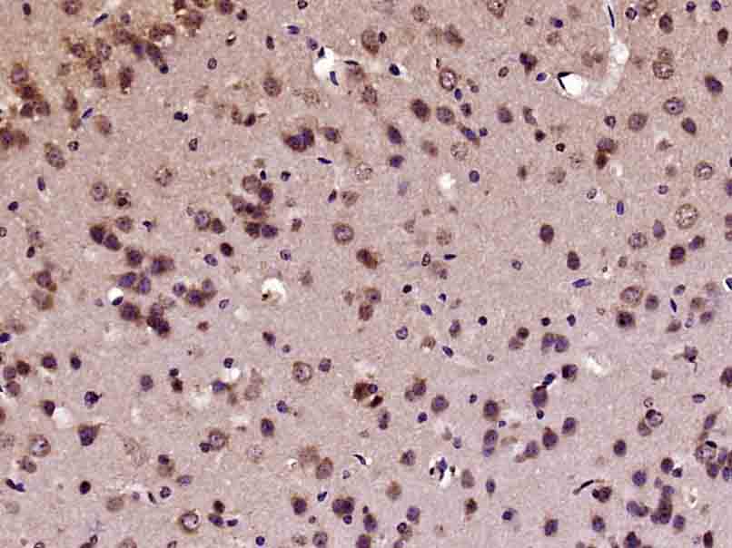 Paraformaldehyde-fixed, paraffin embedded Mouse brain; Antigen retrieval by boiling in sodium citrate buffer (pH6.0) for 15min; Block endogenous peroxidase by 3% hydrogen peroxide for 20 minutes; Blocking buffer (normal goat serum) at 37°C for 30min; Antibody incubation with c-fos Polyclonal Antibody, Unconjugated (bs-0469R) at 1:400 overnight at 4°C, DAB staining.