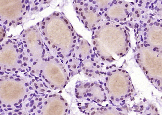 Paraformaldehyde-fixed, paraffin embedded Rat thyroid; Antigen retrieval by boiling in sodium citrate buffer (pH6.0) for 15min; Block endogenous peroxidase by 3% hydrogen peroxide for 20 minutes; Blocking buffer (normal goat serum) at 37°C for 30min; Antibody incubation with Beta arrestin 2 Polyclonal Antibody, Unconjugated (bs-1332R) at 1:400 overnight at 4°C, DAB staining.