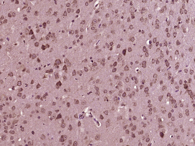 Paraformaldehyde-fixed, paraffin embedded Mouse brain; Antigen retrieval by boiling in sodium citrate buffer (pH6.0) for 15min; Block endogenous peroxidase by 3% hydrogen peroxide for 20 minutes; Blocking buffer (normal goat serum) at 37°C for 30min; Antibody incubation with MLK3 Polyclonal Antibody, Unconjugated (bs-2992R) at 1:400 overnight at 4°C, DAB staining.