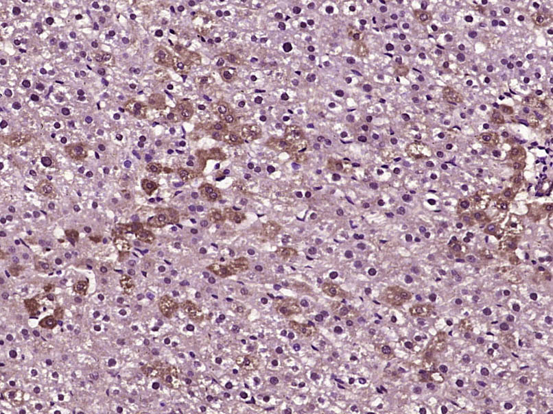 Paraformaldehyde-fixed, paraffin embedded Rat liver; Antigen retrieval by boiling in sodium citrate buffer (pH6.0) for 15min; Block endogenous peroxidase by 3% hydrogen peroxide for 20 minutes; Blocking buffer (normal goat serum) at 37°C for 30min; Antibody incubation with MLK3 Polyclonal Antibody, Unconjugated (bs-2992R) at 1:400 overnight at 4°C, DAB staining.