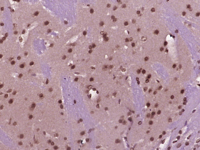 Paraformaldehyde-fixed, paraffin embedded Mouse brain; Antigen retrieval by boiling in sodium citrate buffer (pH6.0) for 15min; Block endogenous peroxidase by 3% hydrogen peroxide for 20 minutes; Blocking buffer (normal goat serum) at 37°C for 30min; Antibody incubation with IRAK1 (Ser376) Polyclonal Antibody, Unconjugated (bs-3192R) at 1:400 overnight at 4°C, DAB staining.
