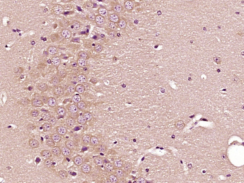 Paraformaldehyde-fixed, paraffin embedded Mouse brain; Antigen retrieval by boiling in sodium citrate buffer (pH6.0) for 15min; Block endogenous peroxidase by 3% hydrogen peroxide for 20 minutes; Blocking buffer (normal goat serum) at 37°C for 30min; Antibody incubation with PBR Polyclonal Antibody, Unconjugated (bs-3674R) at 1:400 overnight at 4°C, DAB staining.