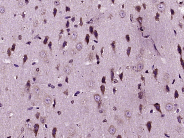 Paraformaldehyde-fixed, paraffin embedded Rat brain; Antigen retrieval by boiling in sodium citrate buffer (pH6.0) for 15min; Block endogenous peroxidase by 3% hydrogen peroxide for 20 minutes; Blocking buffer (normal goat serum) at 37°C for 30min; Antibody incubation with MMP-1 Polyclonal Antibody, Unconjugated (bs-4597R) at 1:400 overnight at 4°C, DAB staining.