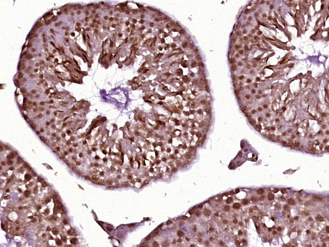 Paraformaldehyde-fixed, paraffin embedded Mouse testis; Antigen retrieval by boiling in sodium citrate buffer (pH6.0) for 15min; Block endogenous peroxidase by 3% hydrogen peroxide for 20 minutes; Blocking buffer (normal goat serum) at 37°C for 30min; Antibody incubation with CDC25A, CDC25B and CDC25C Polyclonal Antibody, Unconjugated (bs-10579R) at 1:400 overnight at 4°C, DAB staining.