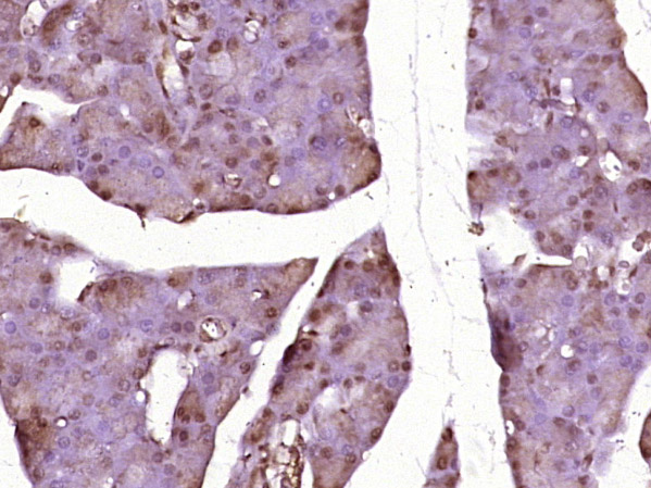 Paraformaldehyde-fixed, paraffin embedded Rat pancreas; Antigen retrieval by boiling in sodium citrate buffer (pH6.0) for 15min; Block endogenous peroxidase by 3% hydrogen peroxide for 20 minutes; Blocking buffer (normal goat serum) at 37°C for 30min; Antibody incubation with CDC25A, CDC25B and CDC25C Polyclonal Antibody, Unconjugated (bs-10579R) at 1:400 overnight at 4°C, DAB staining.