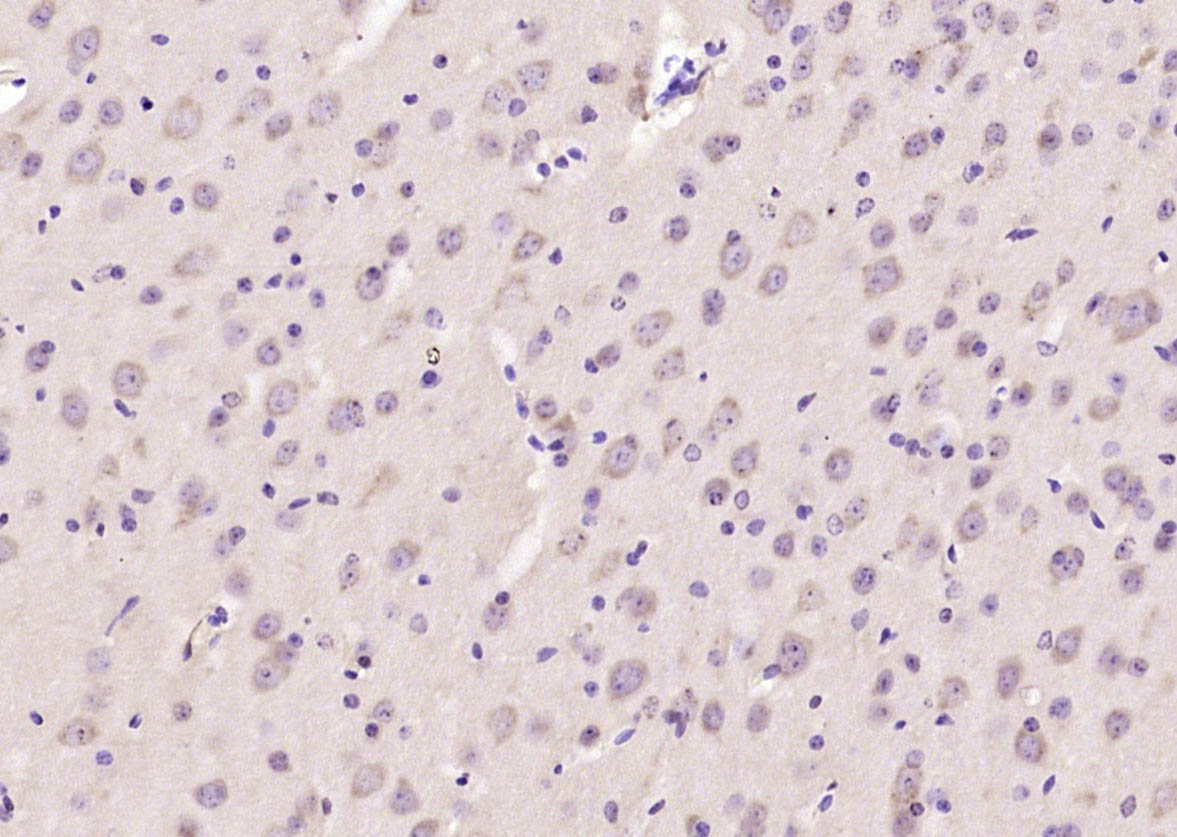 Paraformaldehyde-fixed, paraffin embedded Mouse brain; Antigen retrieval by boiling in sodium citrate buffer (pH6.0) for 15min; Block endogenous peroxidase by 3% hydrogen peroxide for 20 minutes; Blocking buffer (normal goat serum) at 37°C for 30min; Antibody incubation with GLIS2 Polyclonal Antibody, Unconjugated (bs-11566R) at 1:200 overnight at 4°C, DAB staining.