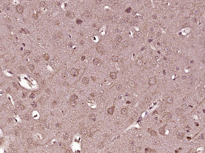 Paraformaldehyde-fixed, paraffin embedded Mouse brain; Antigen retrieval by boiling in sodium citrate buffer (pH6.0) for 15min; Block endogenous peroxidase by 3% hydrogen peroxide for 20 minutes; Blocking buffer (normal goat serum) at 37°C for 30min; Antibody incubation with KIF13A Polyclonal Antibody, Unconjugated (bs-17040R) at 1:400 overnight at 4°C, DAB staining.