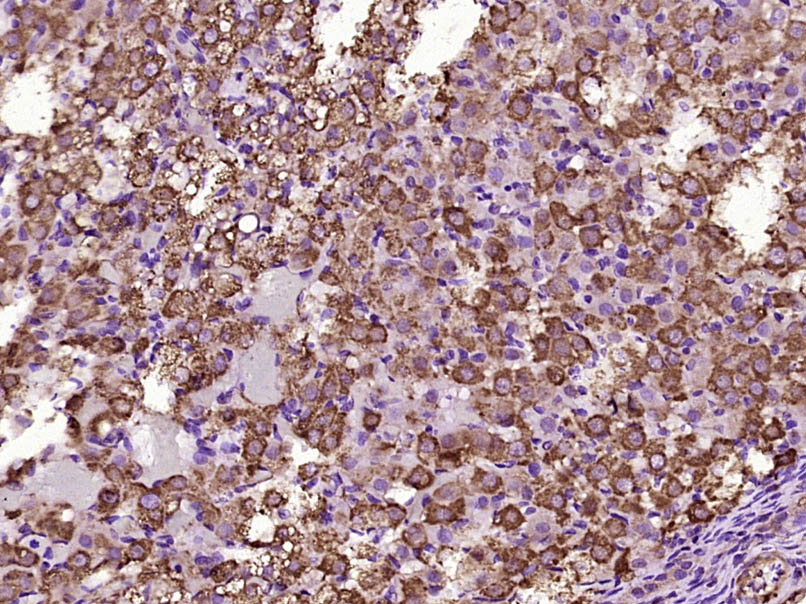 Paraformaldehyde-fixed, paraffin embedded Rat ovarian; Antigen retrieval by boiling in sodium citrate buffer (pH6.0) for 15min; Block endogenous peroxidase by 3% hydrogen peroxide for 20 minutes; Blocking buffer (normal goat serum) at 37°C for 30min; Antibody incubation with KIF13A Polyclonal Antibody, Unconjugated (bs-17040R) at 1:400 overnight at 4°C, DAB staining. Paraformaldehyde-fixed, paraffin embedded Rat ovarian; Antigen retrieval by boiling in sodium citrate buffer (pH6.0) for 15min; Block endogenous peroxidase by 3% hydrogen peroxide for 20 minutes; Blocking buffer (normal goat serum) at 37°C for 30min; Antibody incubation with KIF13A Polyclonal Antibody, Unconjugated (bs-17040R) at 1:400 overnight at 4°C, DAB staining.