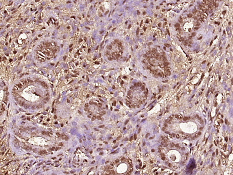 Paraformaldehyde-fixed, paraffin embedded Mouse uterus; Antigen retrieval by boiling in sodium citrate buffer (pH6.0) for 15min; Block endogenous peroxidase by 3% hydrogen peroxide for 20 minutes; Blocking buffer (normal goat serum) at 37°C for 30min; Antibody incubation with MED18 Polyclonal Antibody, Unconjugated (bs-18764R) at 1:400 overnight at 4°C, DAB staining.