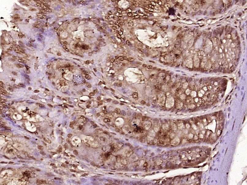 Paraformaldehyde-fixed, paraffin embedded Rat colon; Antigen retrieval by boiling in sodium citrate buffer (pH6.0) for 15min; Block endogenous peroxidase by 3% hydrogen peroxide for 20 minutes; Blocking buffer (normal goat serum) at 37°C for 30min; Antibody incubation with MED18 Polyclonal Antibody, Unconjugated (bs-18764R) at 1:400 overnight at 4°C, DAB staining.