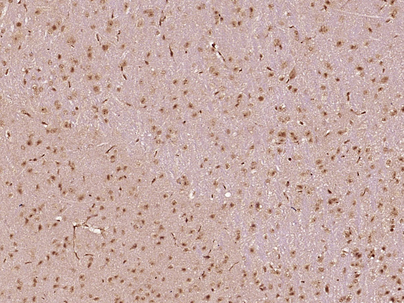 Paraformaldehyde-fixed, paraffin embedded Mouse brain; Antigen retrieval by boiling in sodium citrate buffer (pH6.0) for 15min; Block endogenous peroxidase by 3% hydrogen peroxide for 20 minutes; Blocking buffer (normal goat serum) at 37°C for 30min; Antibody incubation with MED28 Polyclonal Antibody, Unconjugated (bs-18767R) at 1:400 overnight at 4°C, DAB staining.