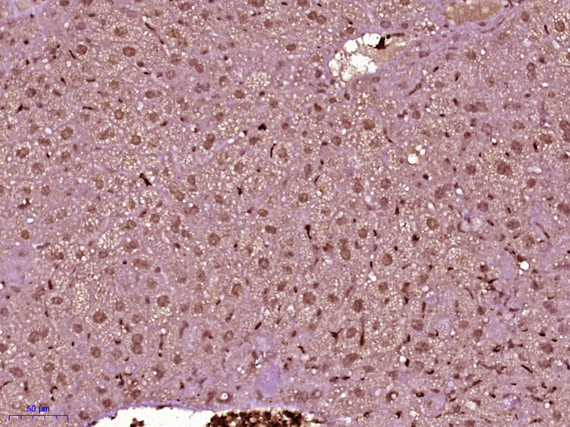 Paraformaldehyde-fixed, paraffin embedded Mouse liver; Antigen retrieval by boiling in sodium citrate buffer (pH6.0) for 15min; Block endogenous peroxidase by 3% hydrogen peroxide for 20 minutes; Blocking buffer (normal goat serum) at 37°C for 30min; Antibody incubation with PRPSAP Polyclonal Antibody, Unconjugated (bs-19410R) at 1:400 overnight at 4°C, DAB staining.