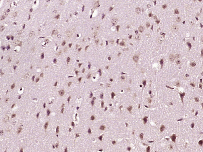 Paraformaldehyde-fixed, paraffin embedded Mouse brain; Antigen retrieval by boiling in sodium citrate buffer (pH6.0) for 15min; Block endogenous peroxidase by 3% hydrogen peroxide for 20 minutes; Blocking buffer (normal goat serum) at 37°C for 30min; Antibody incubation with Nucleobindin 1 Polyclonal Antibody, Unconjugated (bs-19500R) at 1:400 overnight at 4°C, DAB staining.