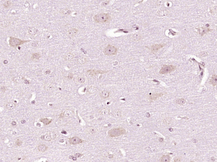 Paraformaldehyde-fixed, paraffin embedded Rat brain; Antigen retrieval by boiling in sodium citrate buffer (pH6.0) for 15min; Block endogenous peroxidase by 3% hydrogen peroxide for 20 minutes; Blocking buffer (normal goat serum) at 37°C for 30min; Antibody incubation with Nucleobindin 1 Polyclonal Antibody, Unconjugated (bs-19500R) at 1:400 overnight at 4°C, DAB staining.