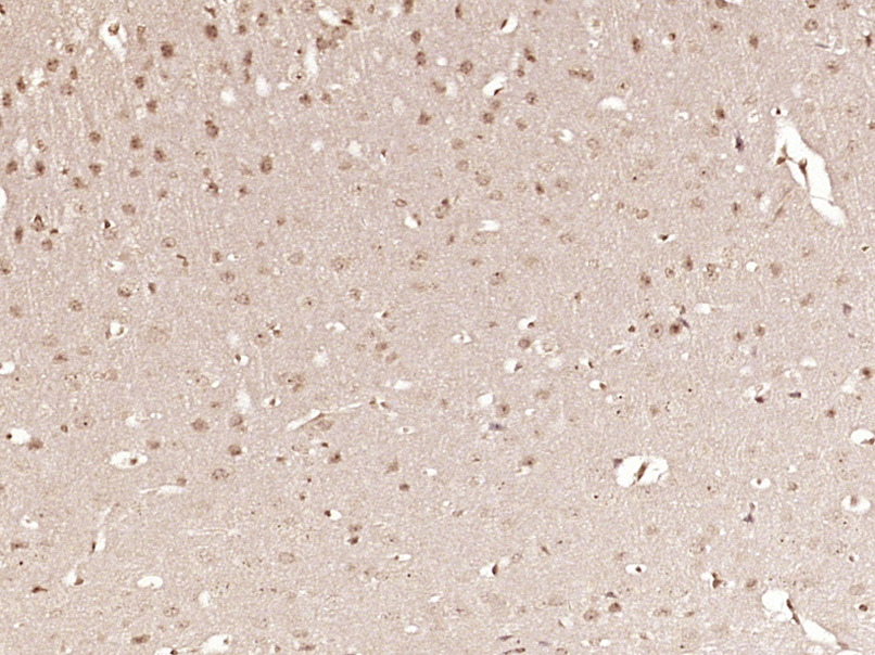 Paraformaldehyde-fixed, paraffin embedded Mouse brain; Antigen retrieval by boiling in sodium citrate buffer (pH6.0) for 15min; Block endogenous peroxidase by 3% hydrogen peroxide for 20 minutes; Blocking buffer (normal goat serum) at 37°C for 30min; Antibody incubation with OASL/TRIP14 Polyclonal Antibody, Unconjugated (bs-19558R) at 1:400 overnight at 4°C, DAB staining.