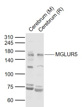 Lane 1: Mouse Cerebrum lysates; Lane 2: Rat Cerebrum lysates probed with MGLUR5 Polyclonal Antibody, Unconjugated (bs-18801R) at 1:1000 dilution and 4˚C overnight incubation. Followed by conjugated secondary antibody incubation at 1:20000 for 60 min at 37˚C.