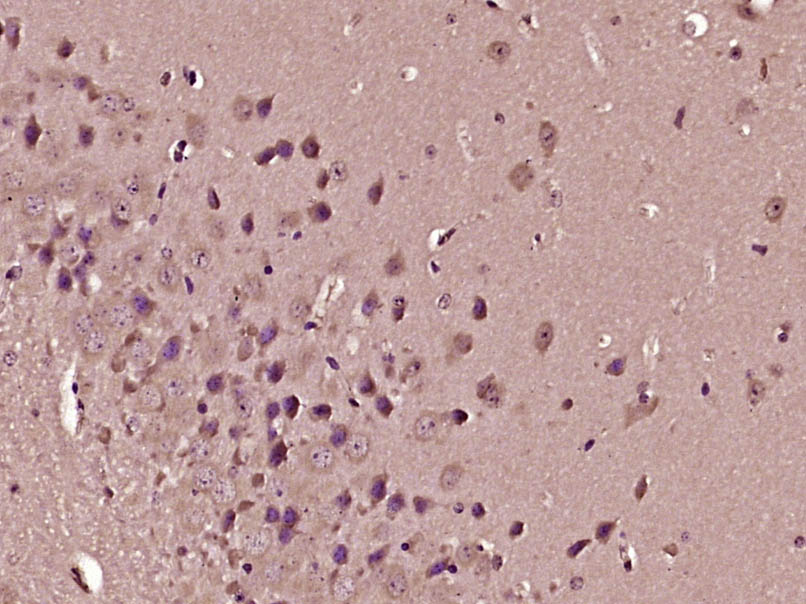 Paraformaldehyde-fixed, paraffin embedded Mouse brain; Antigen retrieval by boiling in sodium citrate buffer (pH6.0) for 15min; Block endogenous peroxidase by 3% hydrogen peroxide for 20 minutes; Blocking buffer (normal goat serum) at 37°C for 30min; Antibody incubation with Apelin Receptor Polyclonal Antibody, Unconjugated (bs-21310R) at 1:400 overnight at 4°C, DAB staining.