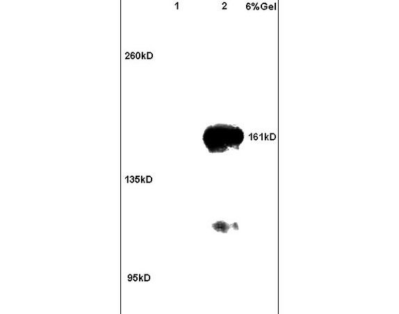 Lane 1: rat brain lysates Lane 2: human colon carcinoma lysates probed with Anti ROCK2 Polyclonal Antibody, Unconjugated (bs-1205R) at 1:200 in 4C. Followed by conjugation to secondary antibody (bs-0295G-HRP) at 1:3000 90min in 37C. Predicted band 161kD. Observed band size: 161kD
