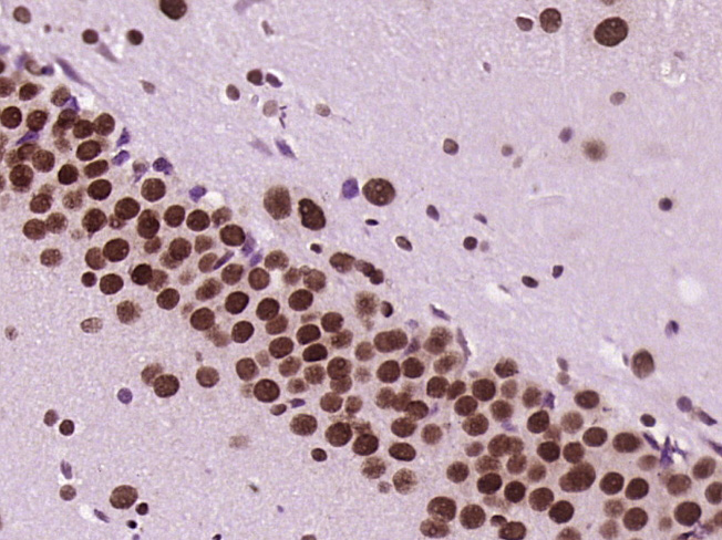 Paraformaldehyde-fixed, paraffin embedded Rat brain; Antigen retrieval by boiling in sodium citrate buffer (pH6.0) for 15min; Block endogenous peroxidase by 3% hydrogen peroxide for 20 minutes; Blocking buffer (normal goat serum) at 37°C for 30min; Antibody incubation with B MyB Polyclonal Antibody, Unconjugated (bs-5960R) at 1:400 overnight at 4°C, DAB staining.