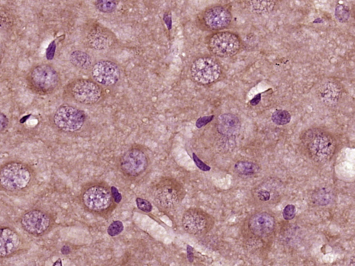 Paraformaldehyde-fixed, paraffin embedded Rat brain; Antigen retrieval by boiling in sodium citrate buffer (pH6.0) for 15min; Block endogenous peroxidase by 3% hydrogen peroxide for 20 minutes; Blocking buffer (normal goat serum) at 37°C for 30min; Antibody incubation with Nidogen Polyclonal Antibody, Unconjugated (bs-6911R) at 1:400 overnight at 4°C, DAB staining.