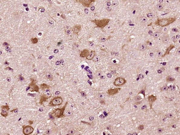 Paraformaldehyde-fixed, paraffin embedded Mouse brain; Antigen retrieval by boiling in sodium citrate buffer (pH6.0) for 15min; Block endogenous peroxidase by 3% hydrogen peroxide for 20 minutes; Blocking buffer (normal goat serum) at 37°C for 30min; Antibody incubation with Nidogen Polyclonal Antibody, Unconjugated (bs-6911R) at 1:400 overnight at 4°C, DAB staining.