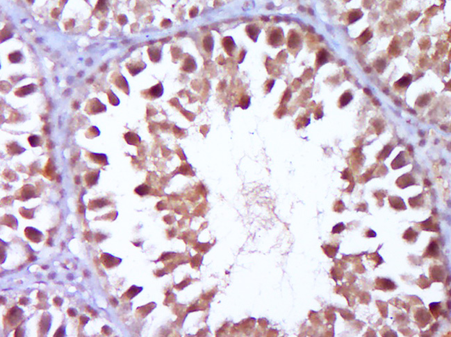 Paraformaldehyde-fixed, paraffin embedded Rat testis; Antigen retrieval by boiling in sodium citrate buffer (pH6.0) for 15min; Block endogenous peroxidase by 3% hydrogen peroxide for 20 minutes; Blocking buffer (normal goat serum) at 37°C for 30min; Antibody incubation with Wilms Tumor Protein Polyclonal Antibody, Unconjugated (bs-6983R) at 1:400 overnight at 4°C, DAB staining.