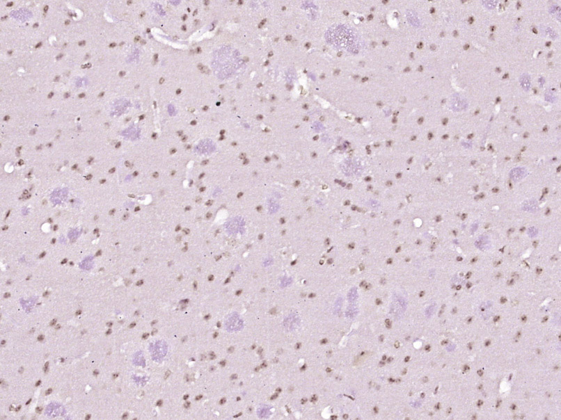 Paraformaldehyde-fixed, paraffin embedded Mouse brain; Antigen retrieval by boiling in sodium citrate buffer (pH6.0) for 15min; Block endogenous peroxidase by 3% hydrogen peroxide for 20 minutes; Blocking buffer (normal goat serum) at 37°C for 30min; Antibody incubation with NOTCH4 Polyclonal Antibody, Unconjugated (bs-7482R) at 1:400 overnight at 4°C, DAB staining.