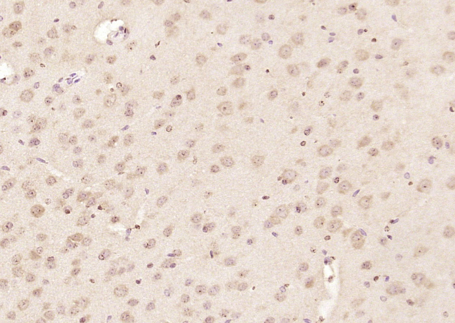Paraformaldehyde-fixed, paraffin embedded Mouse brain; Antigen retrieval by boiling in sodium citrate buffer (pH6.0) for 15min; Block endogenous peroxidase by 3% hydrogen peroxide for 20 minutes; Blocking buffer (normal goat serum) at 37°C for 30min; Antibody incubation with RRAGA + RRAGB Polyclonal Antibody, Unconjugated (bs-10731R) at 1:200 overnight at 4°C, DAB staining.