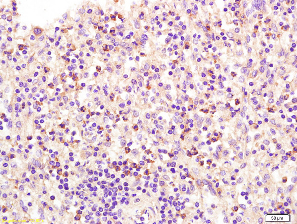 Formalin-fixed and paraffin embedded human spleen labeled with Anti ADCY6 Polyclonal Antibody, Unconjugated (bs-3923R) at 1:200 followed by conjugation to the secondary antibody and DAB staining